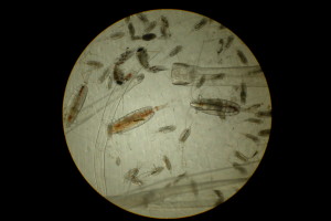 Station178_PlanktonSample